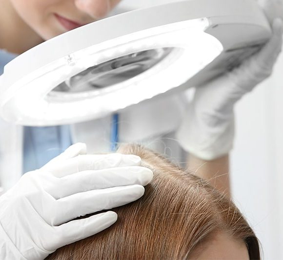 Trapianto di capelli